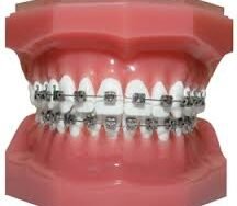 Orthodontics