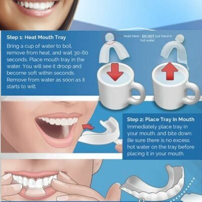 Pearlescence Teeth Whitening System 16% Carbamide Peroxide Gel Kit 